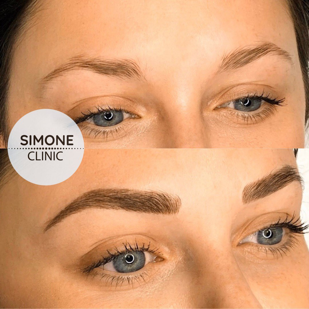 Microblading Eyebrows | Beauty Clinic Simone
